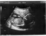 http://forummamici.ro/comunitate/uploads/thumbs/15436_baby_scan_week17_3.jpg