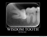 http://forummamici.ro/comunitate/uploads/thumbs/57470_wisdom-tooth-not-that-wise.jpg